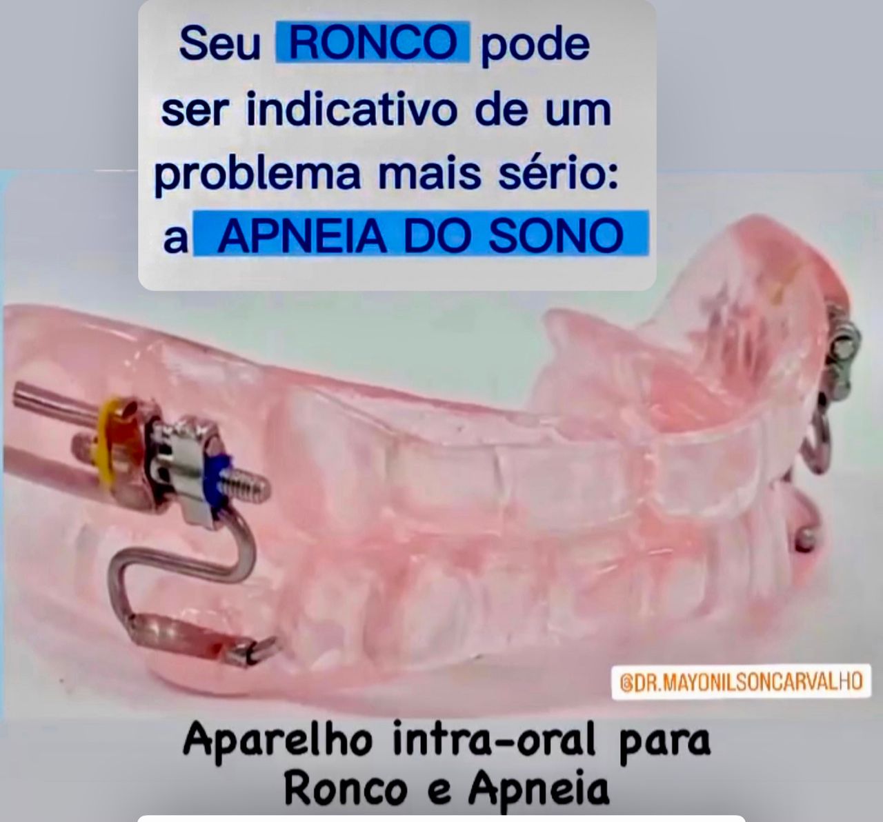 Mayonilson Carvalho-6