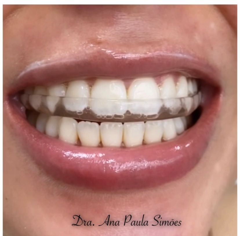 Ana Paula Simões-11