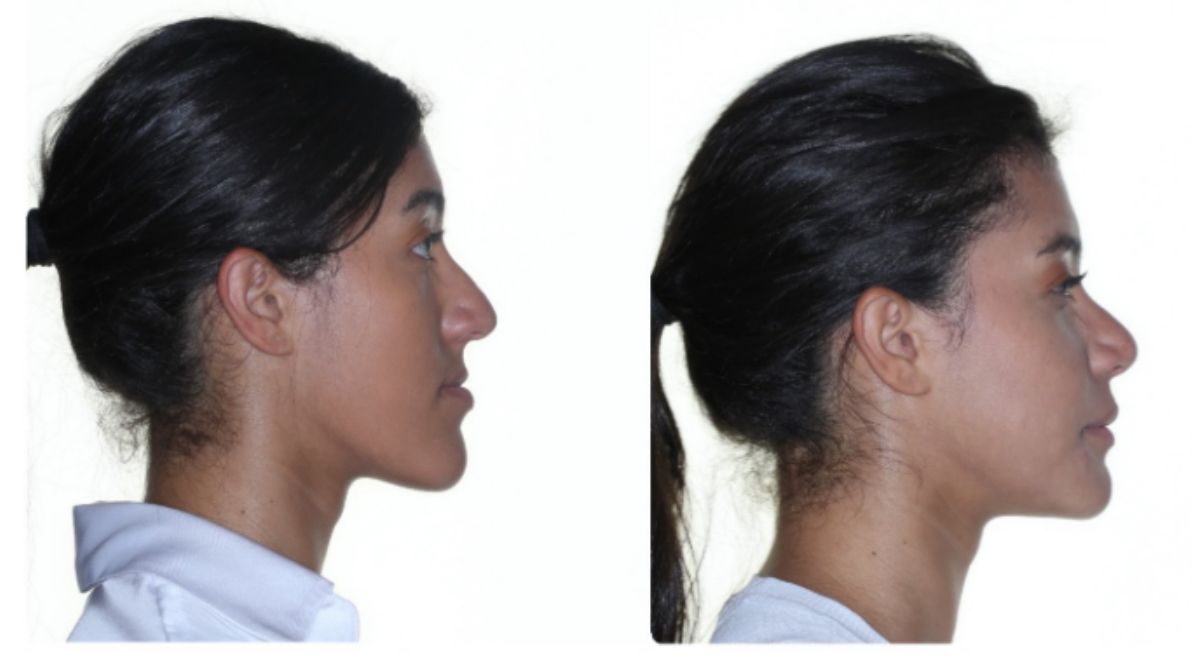 Diego Vinicio Rodriguez Sierra-9