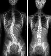 Henrique De Noronha-12