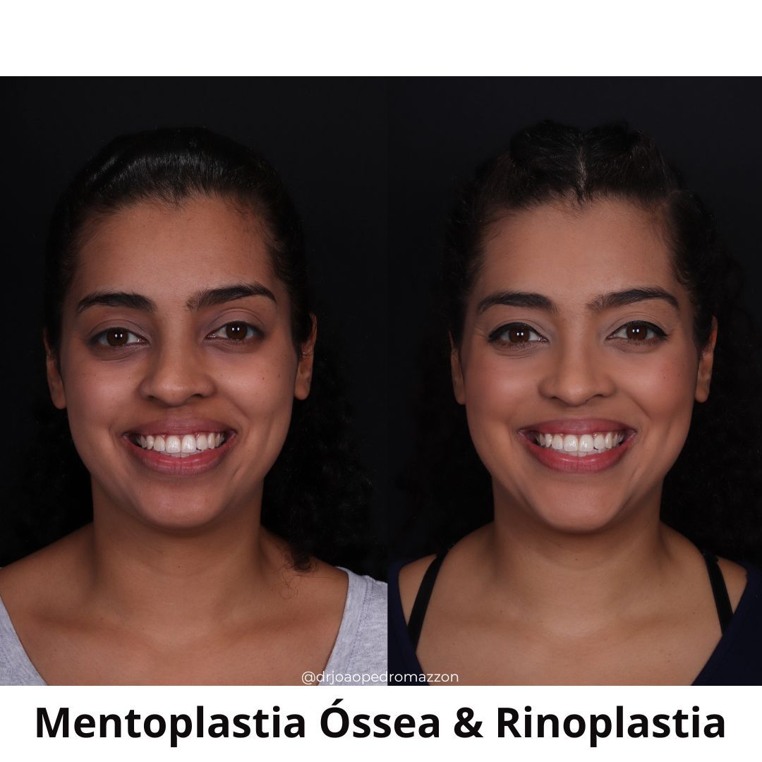 João Pedro Paulino Mazzon-19