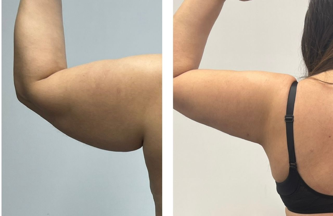 Fernando Oviedo Monsalve-6