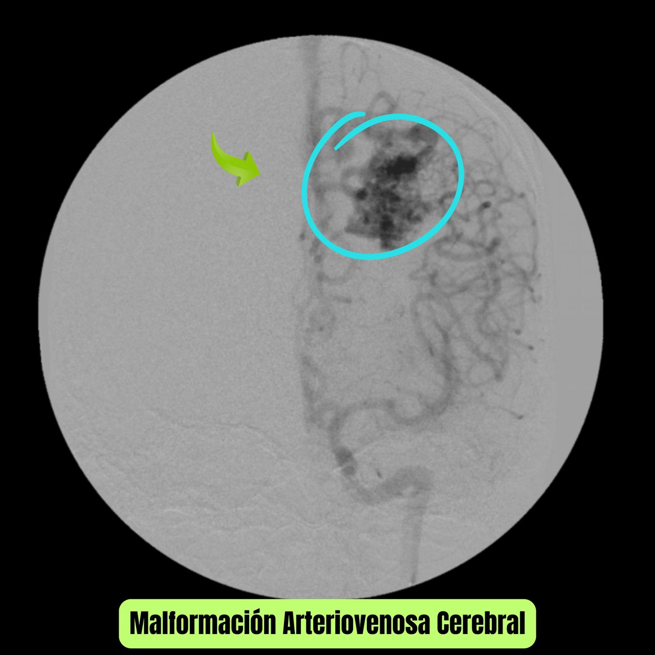 David Tafur Muñoz-1812