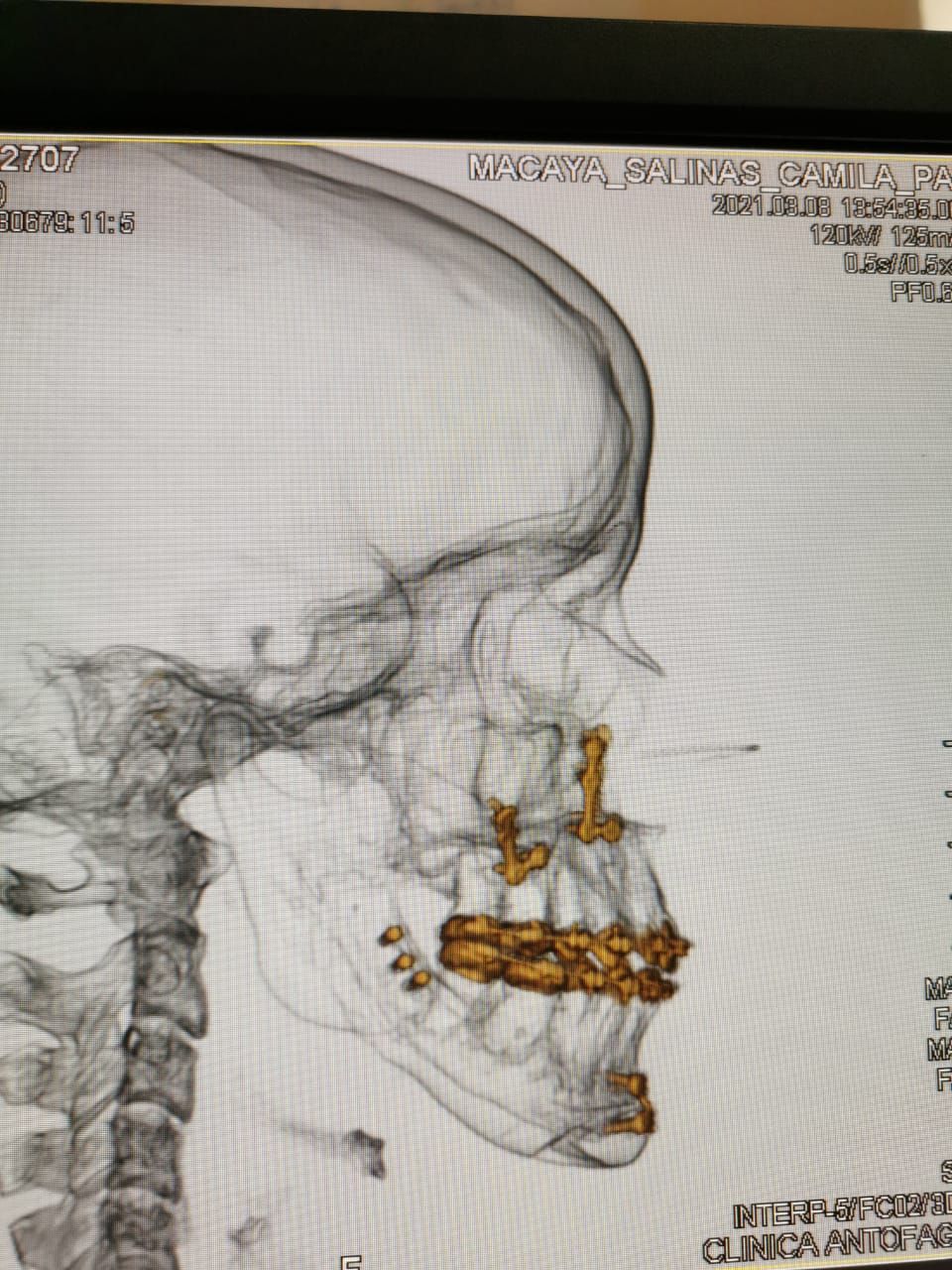 Fernando Germain Edwards-0