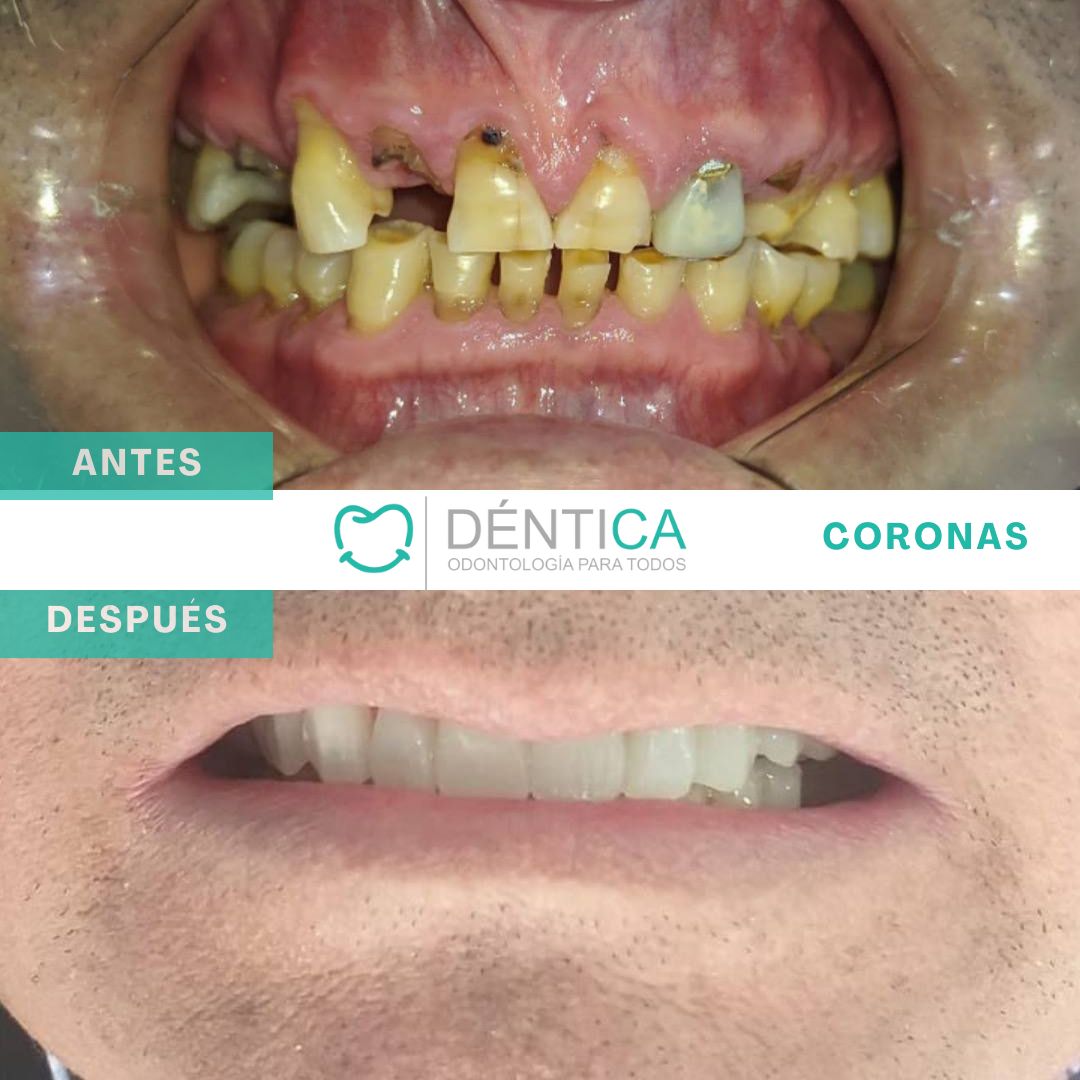 Estefani Canches Caballero-7