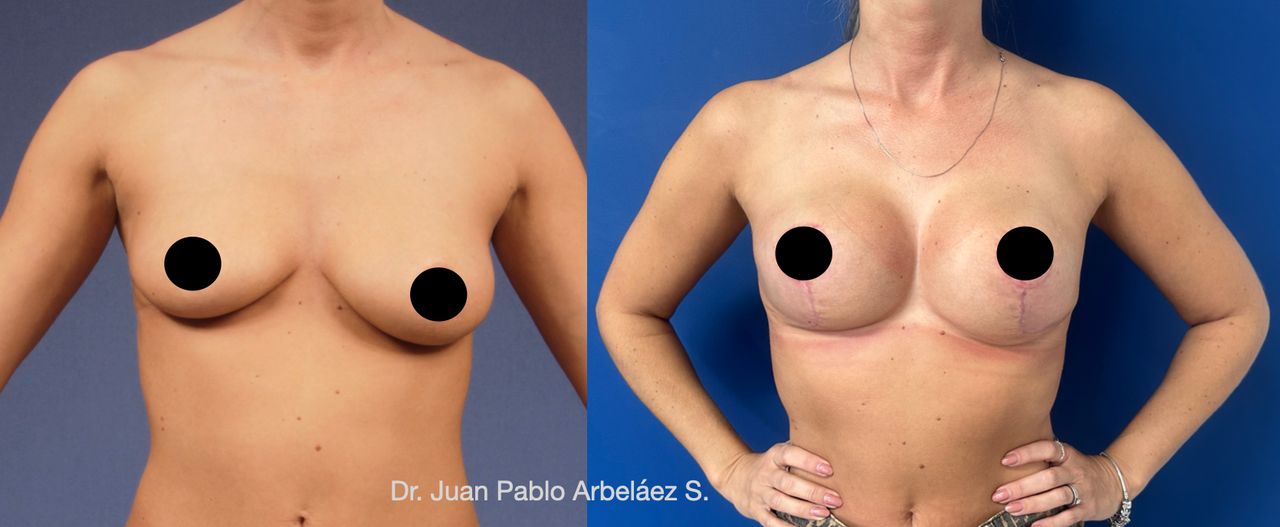 Juan Pablo Arbeláez Sierra-3