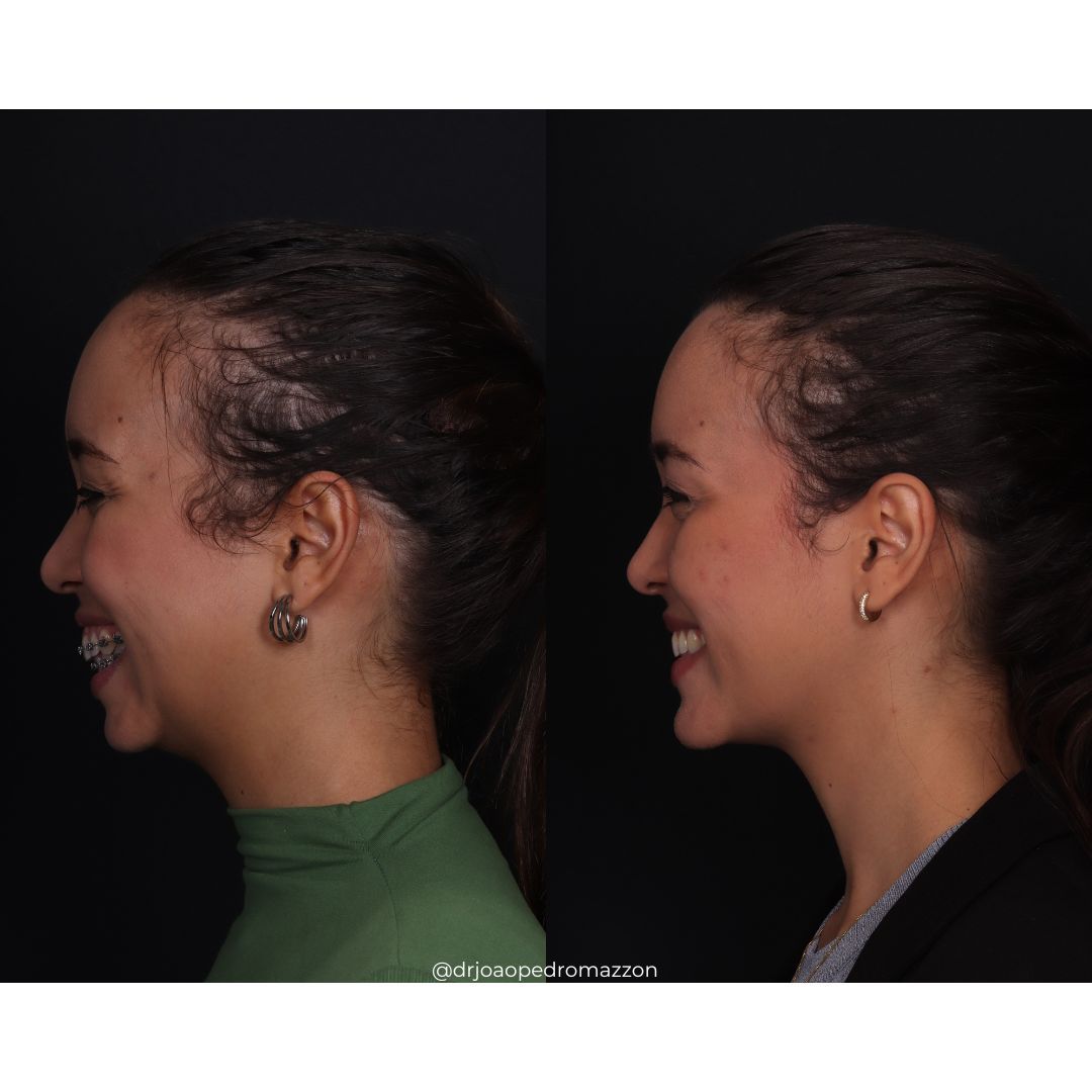 João Pedro Paulino Mazzon-40