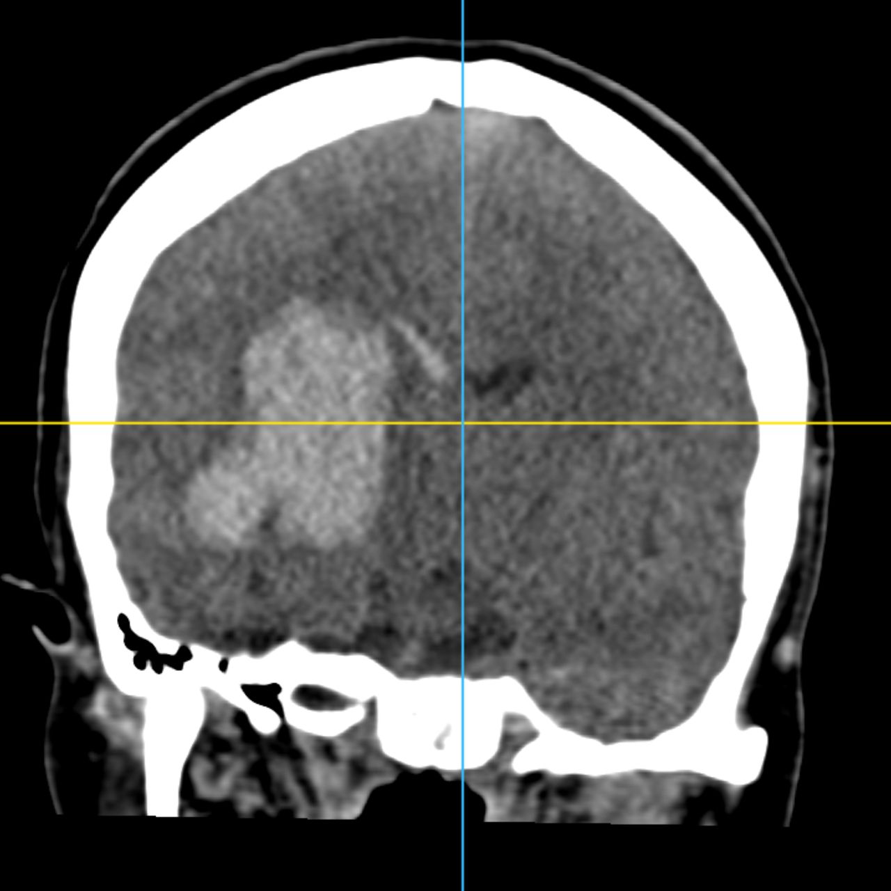 David Tafur Muñoz-2028