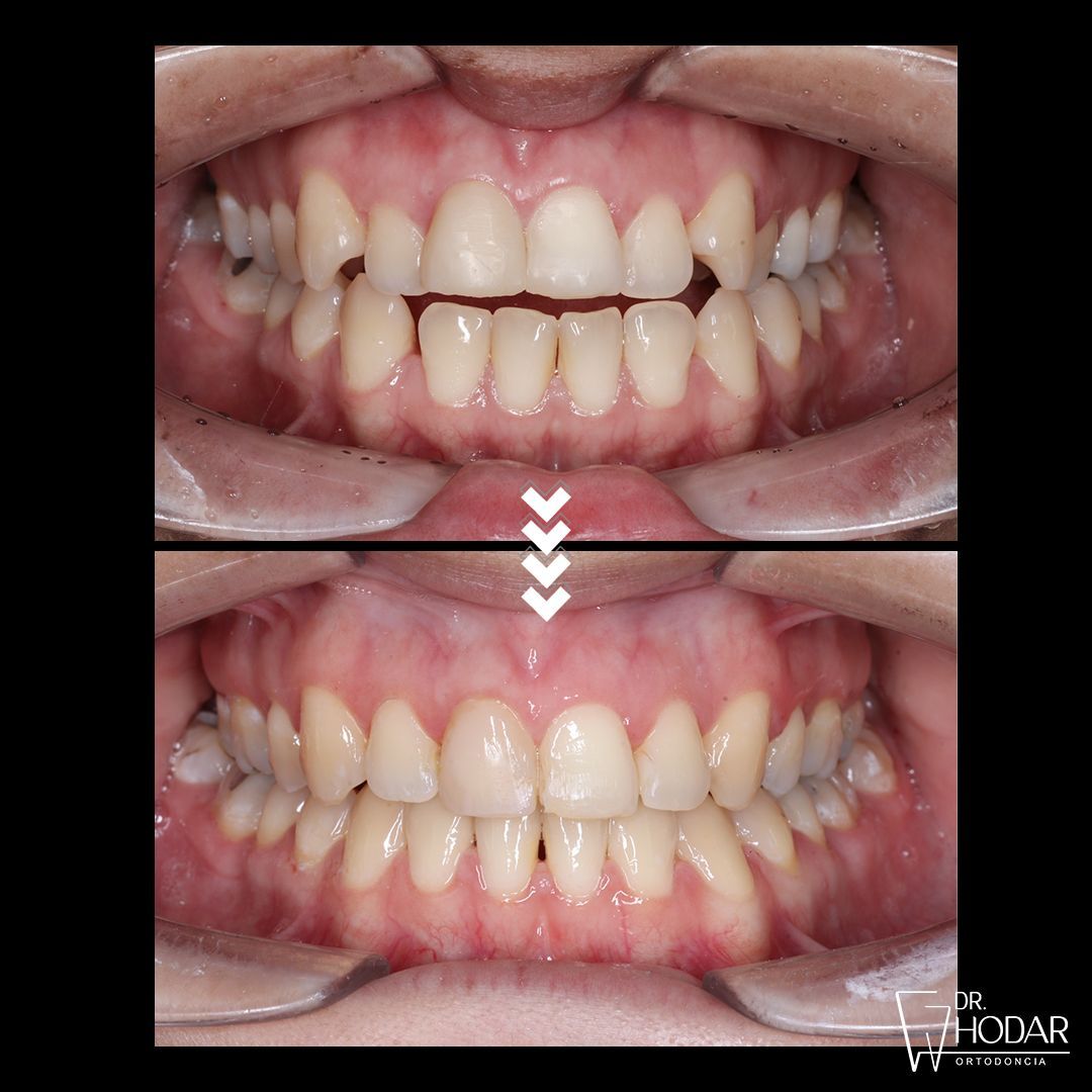 Rodrigo Hodar Dinamarca-4