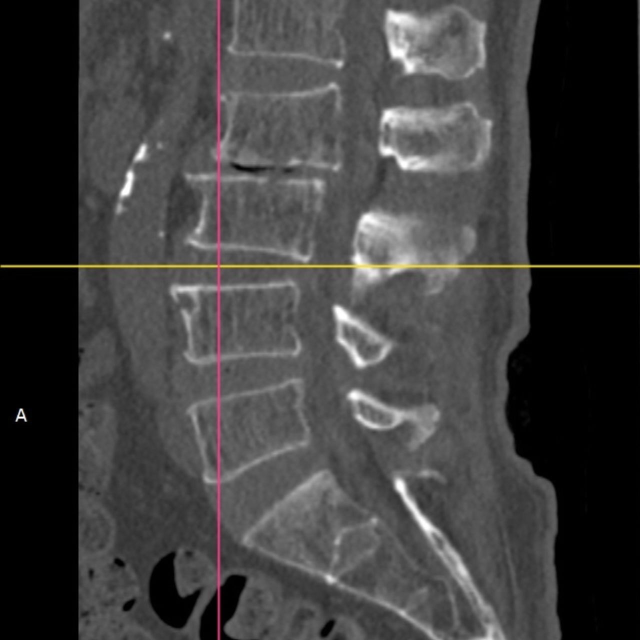 David Tafur Muñoz-1707
