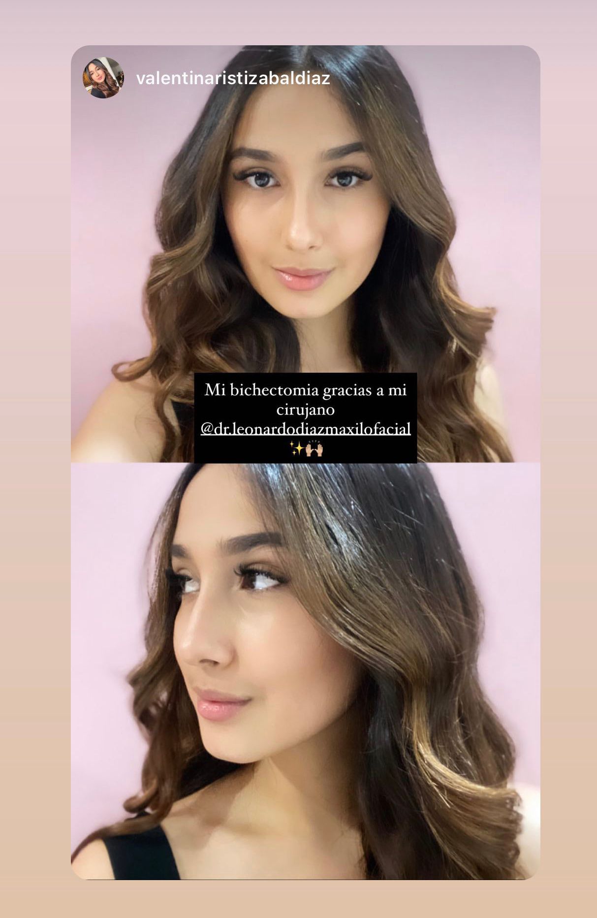 Leonardo Diaz Martínez-18