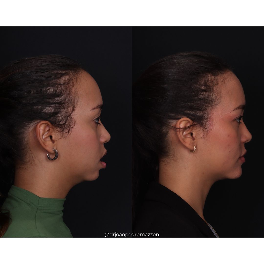 João Pedro Paulino Mazzon-39