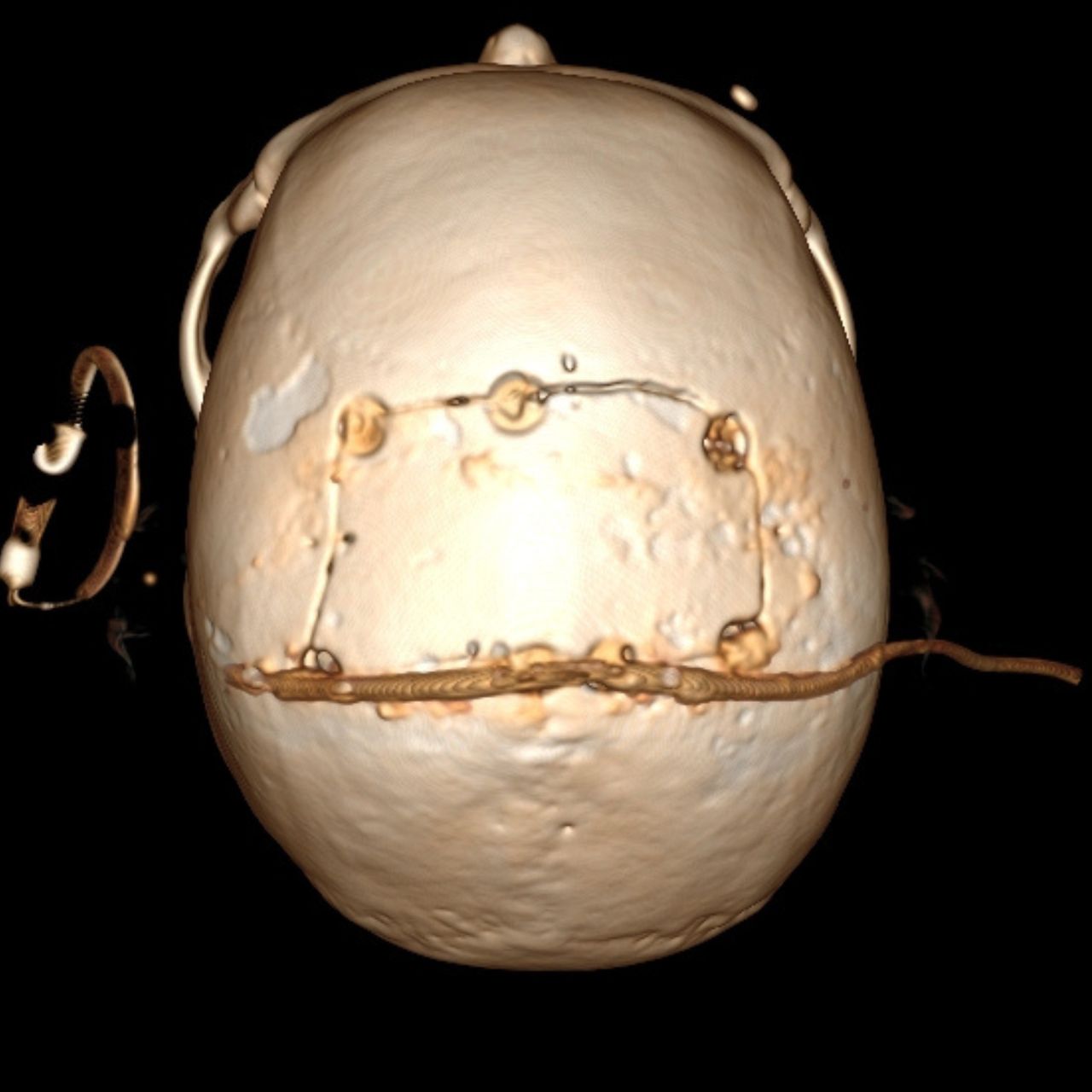 David Tafur Muñoz-1311