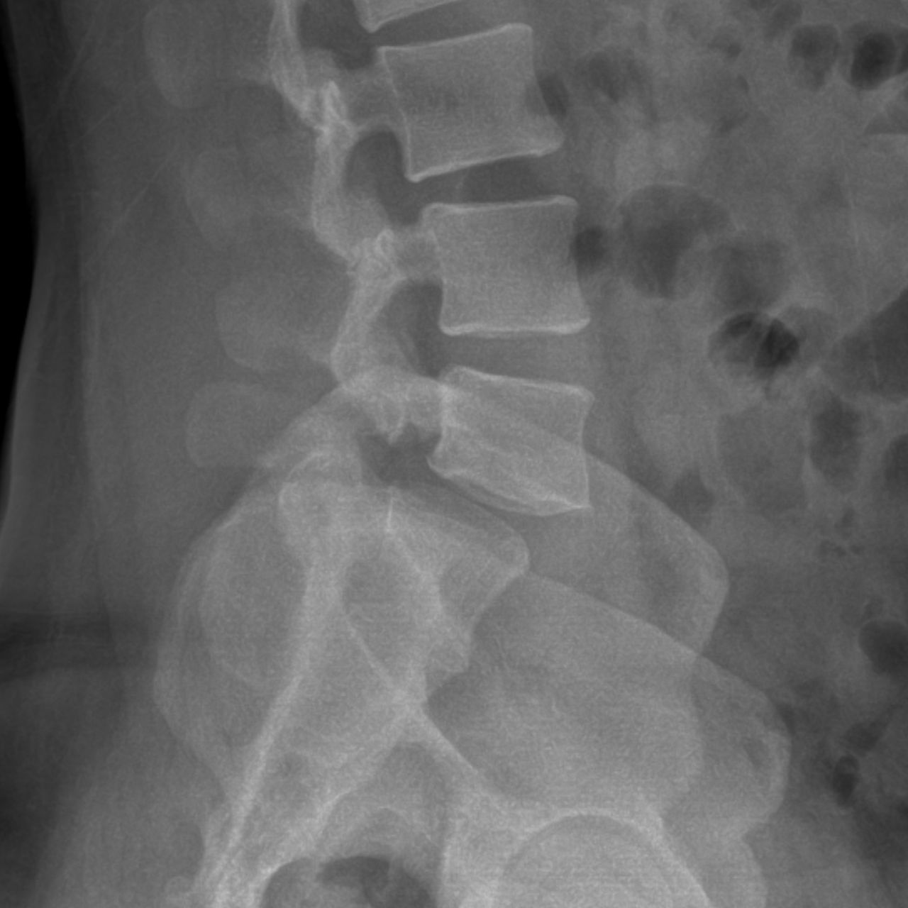 David Tafur Muñoz-2387