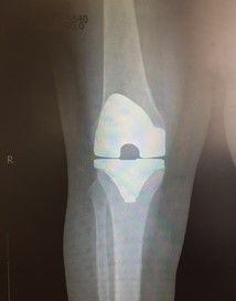 Eduardo Ramalho De Moraes-31