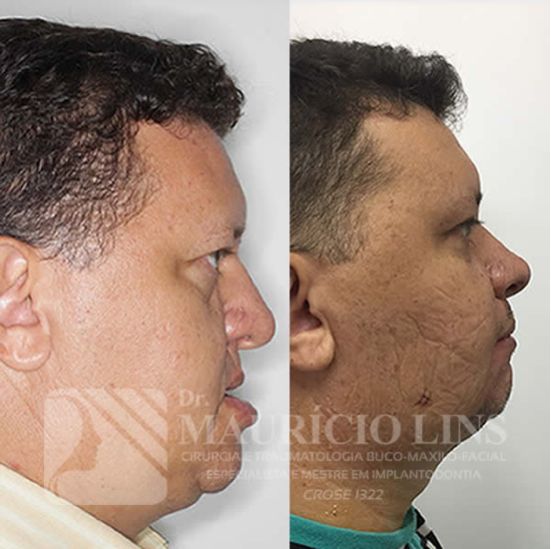 Mauricio Lins Moura-17