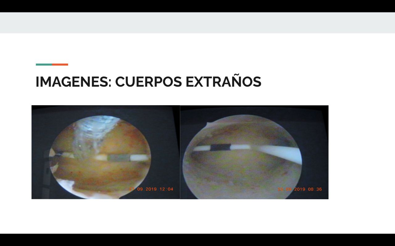 Iván Salgado Berrocal-0