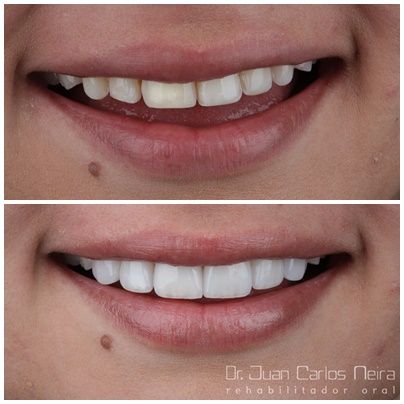 Juan Carlos Neira Rueda-10