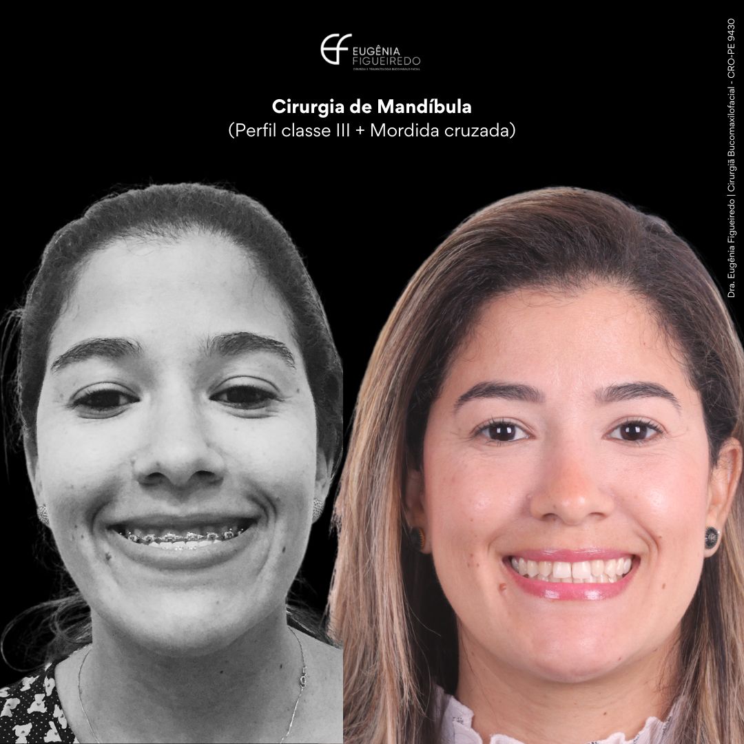 Eugênia Figueiredo-38
