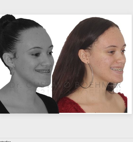 Gustavo Boehmer Leite-7