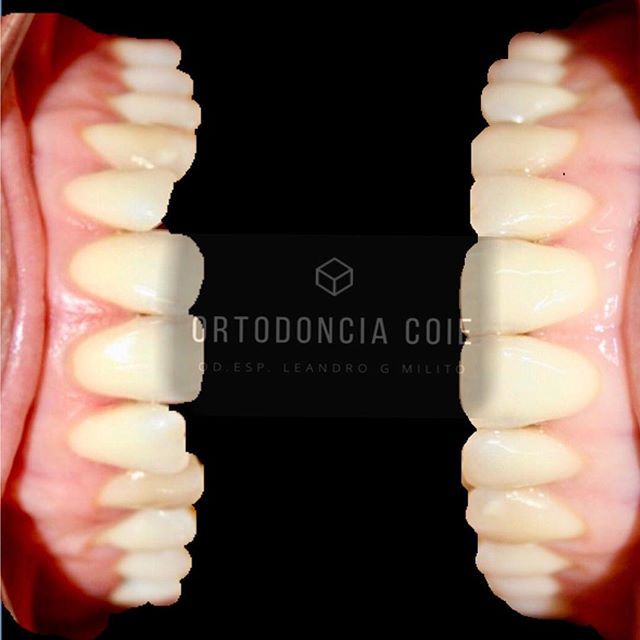 Leandro G. Milito-15