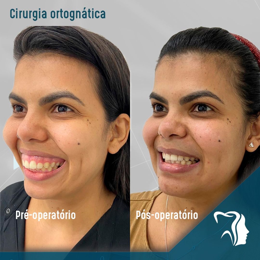 Carlos Alysson Aragão-26