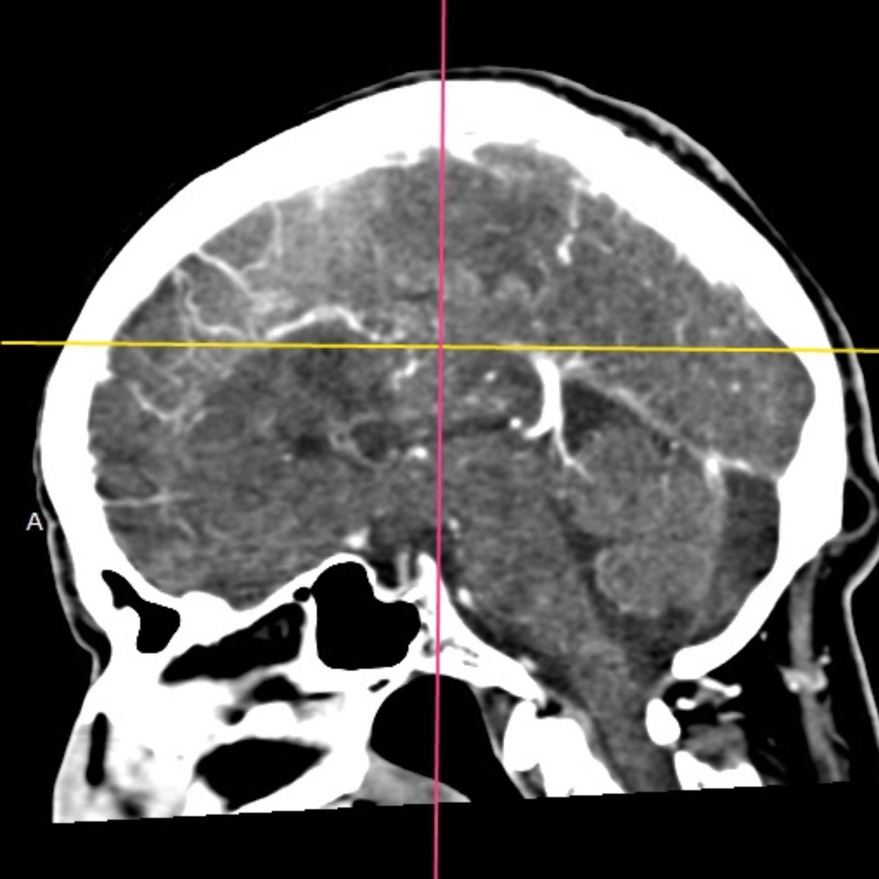 David Tafur Muñoz-1602