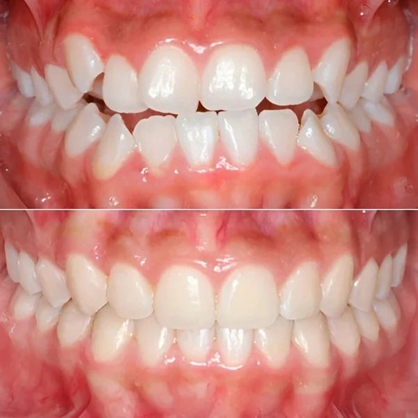 Frank Mendoza Alanya-24