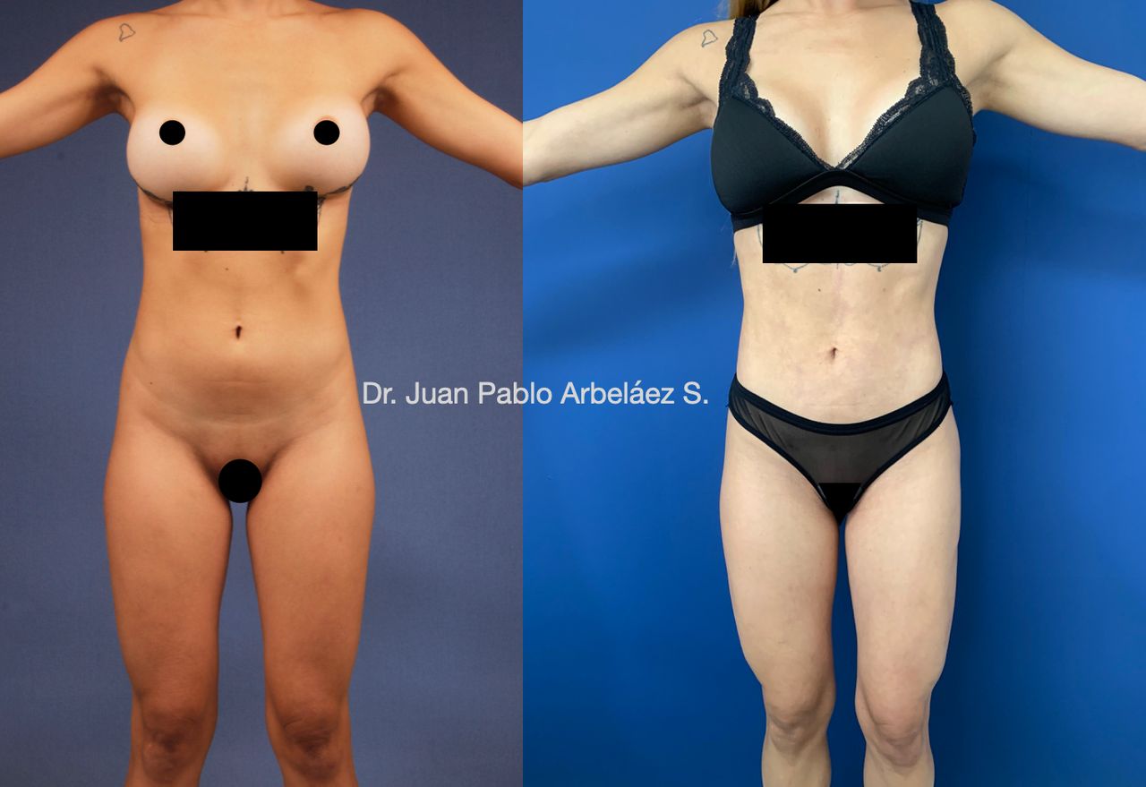 Juan Pablo Arbeláez Sierra-26