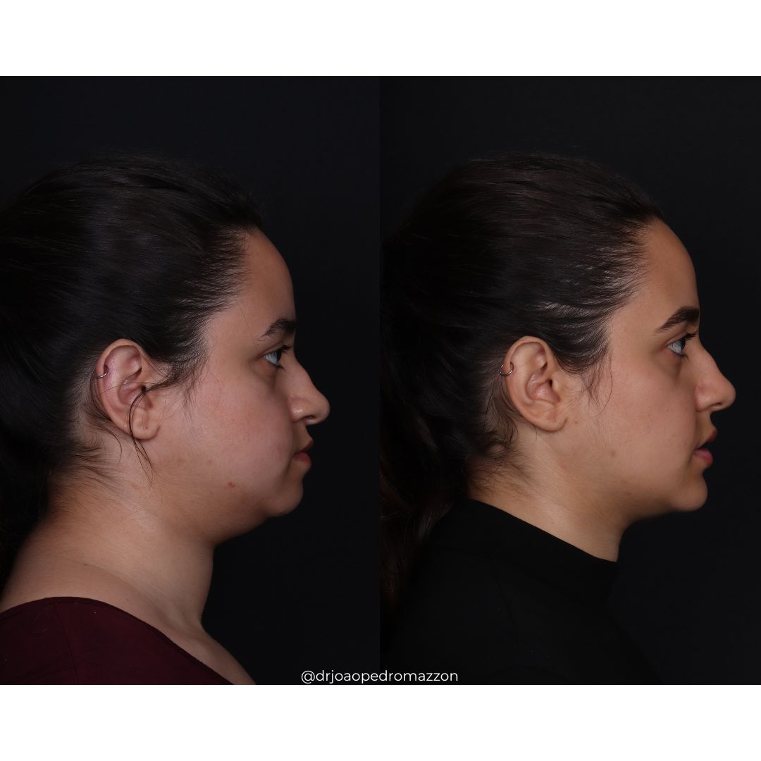 João Pedro Paulino Mazzon-65