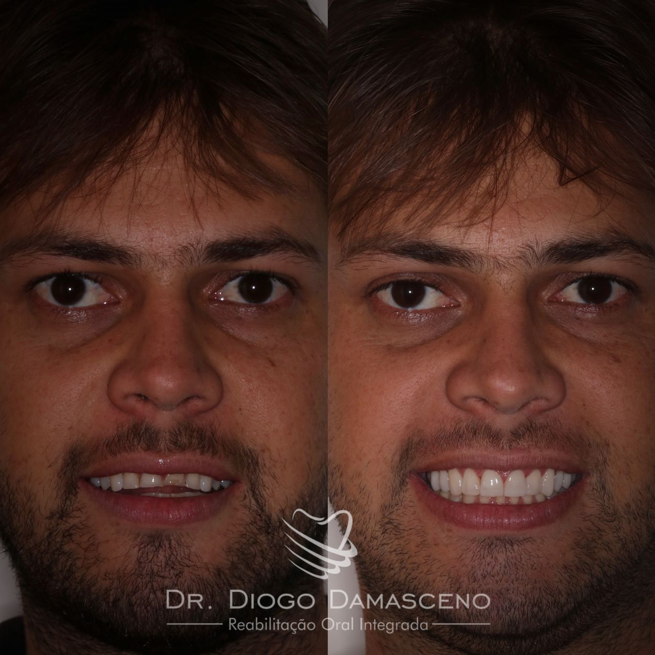 Diogo Damasceno-3
