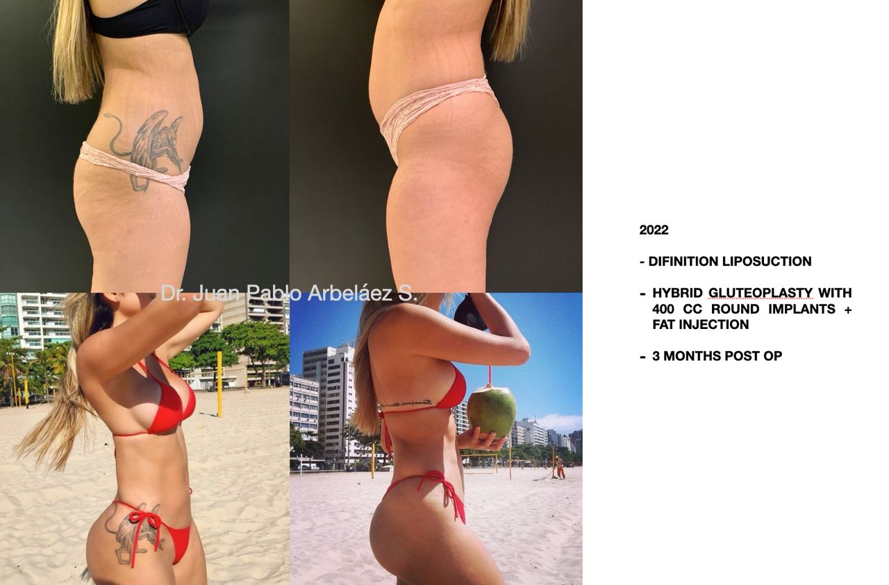 Juan Pablo Arbeláez Sierra-14