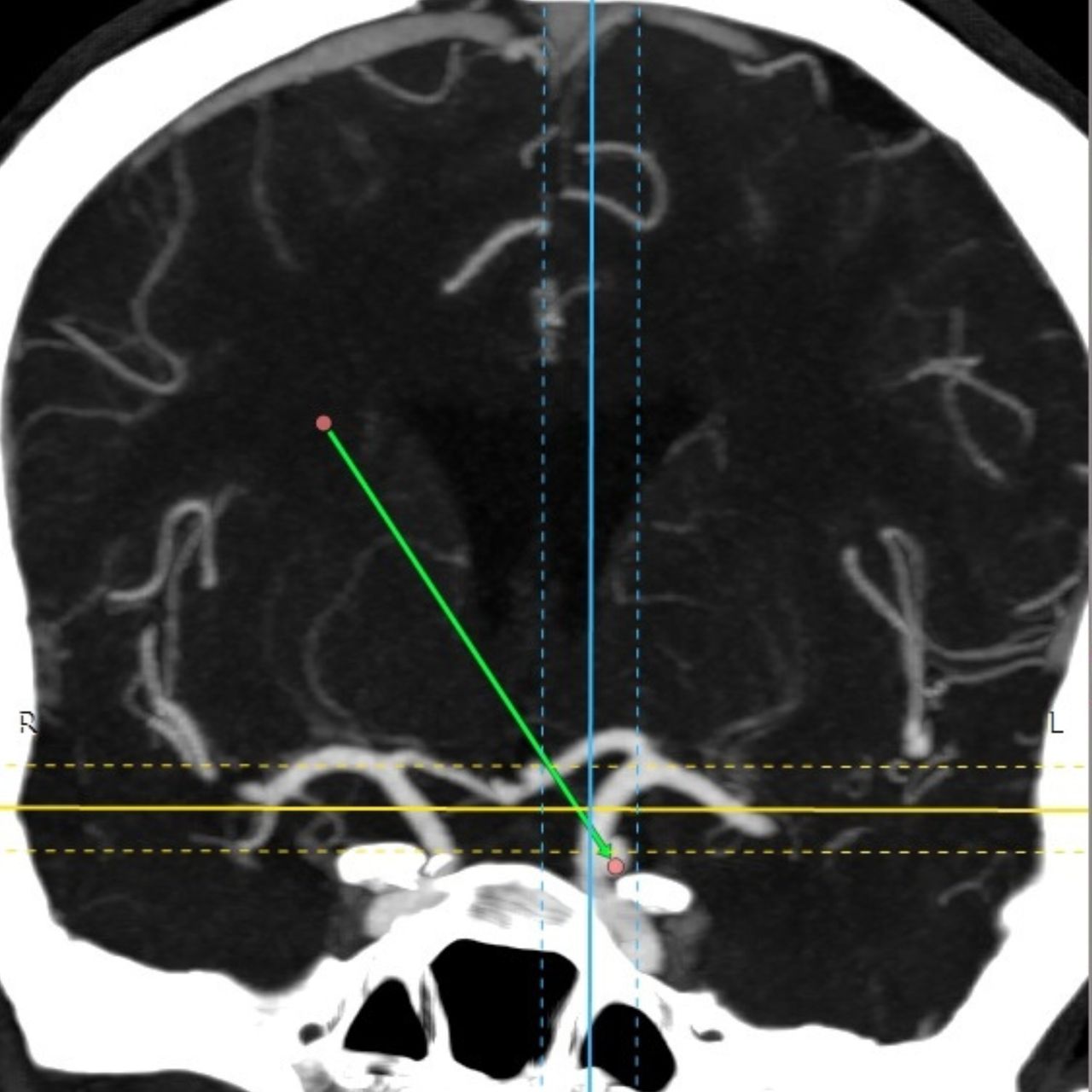 David Tafur Muñoz-1335