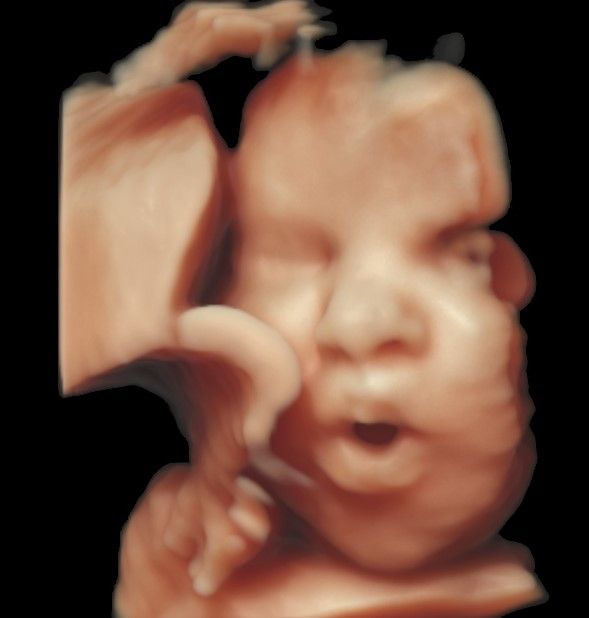 Charles Schwantz De Lima-10