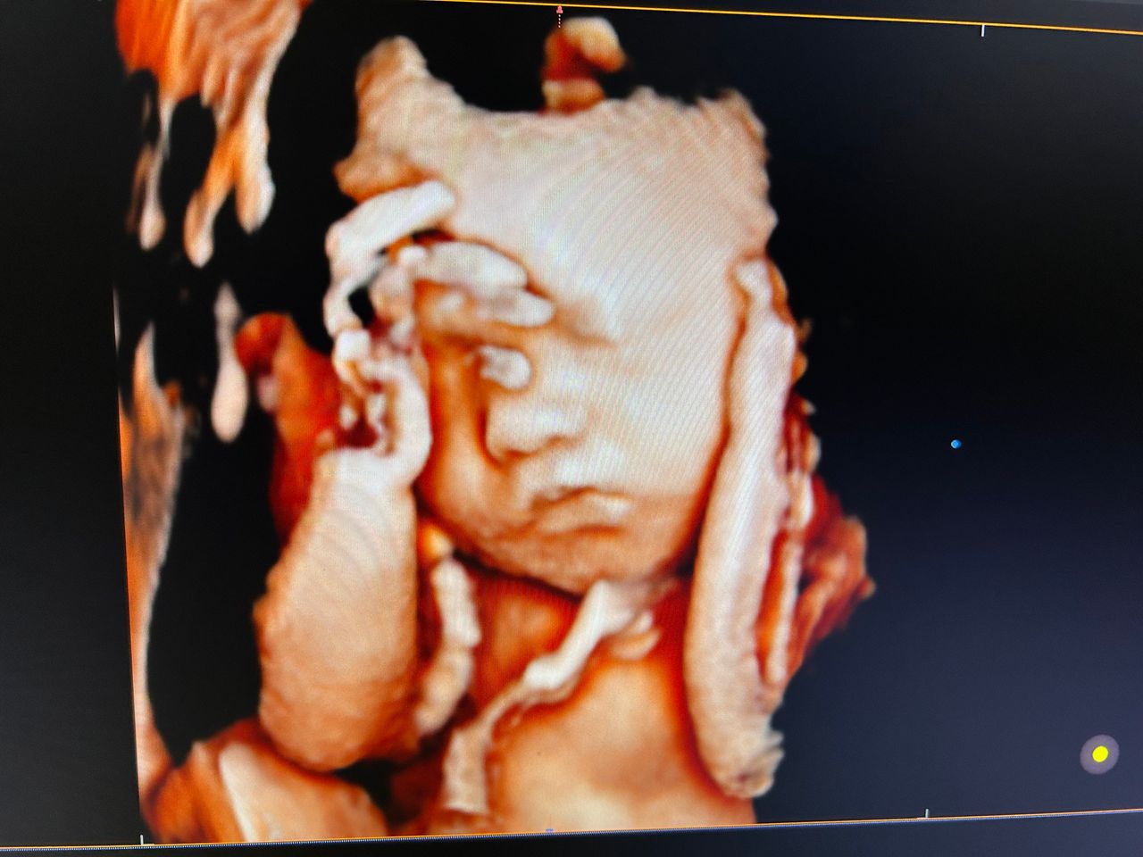 Leandro Nogueira Freitas-3