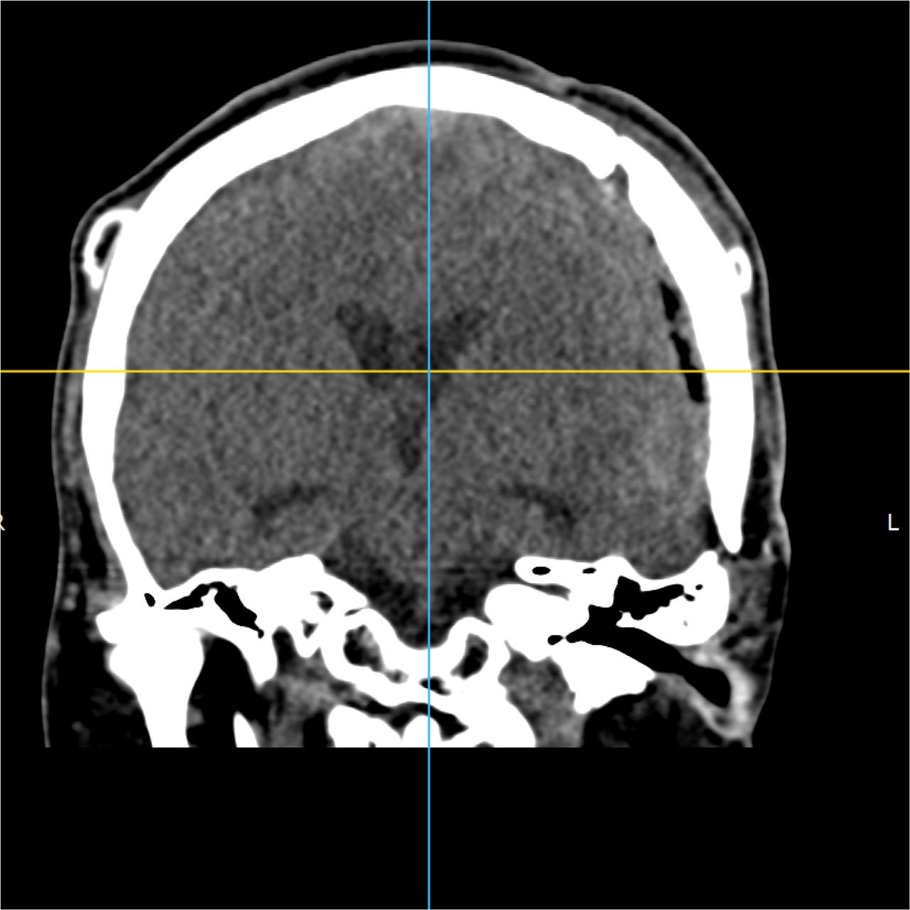 David Tafur Muñoz-2068
