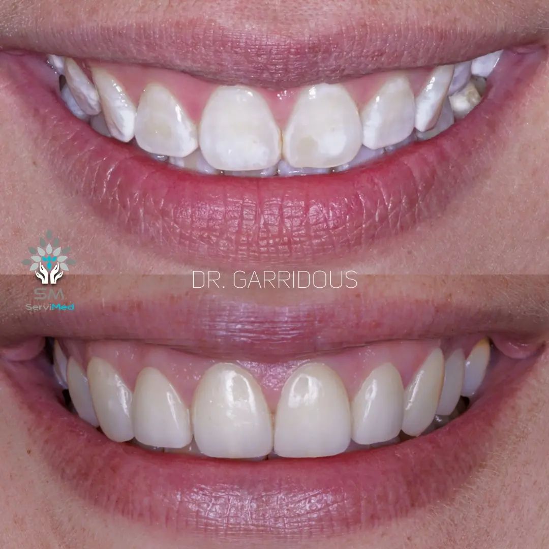 Javier Garrido Tirado-14