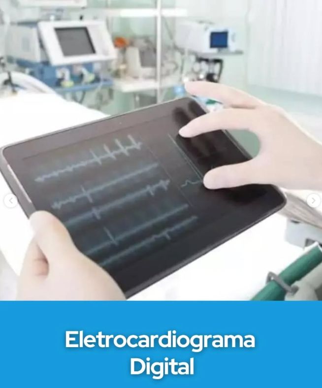 Exame Eletrocardiograma-0
