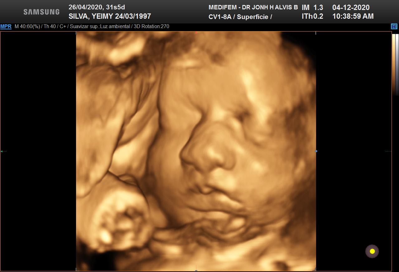 Jonh Harold Alvis Botello-11