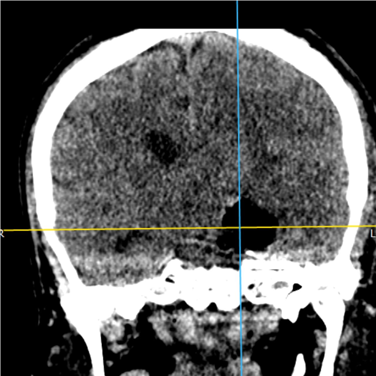 David Tafur Muñoz-1535