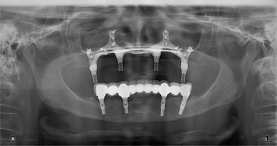 Jose Vicente Rocha Fernandez-31