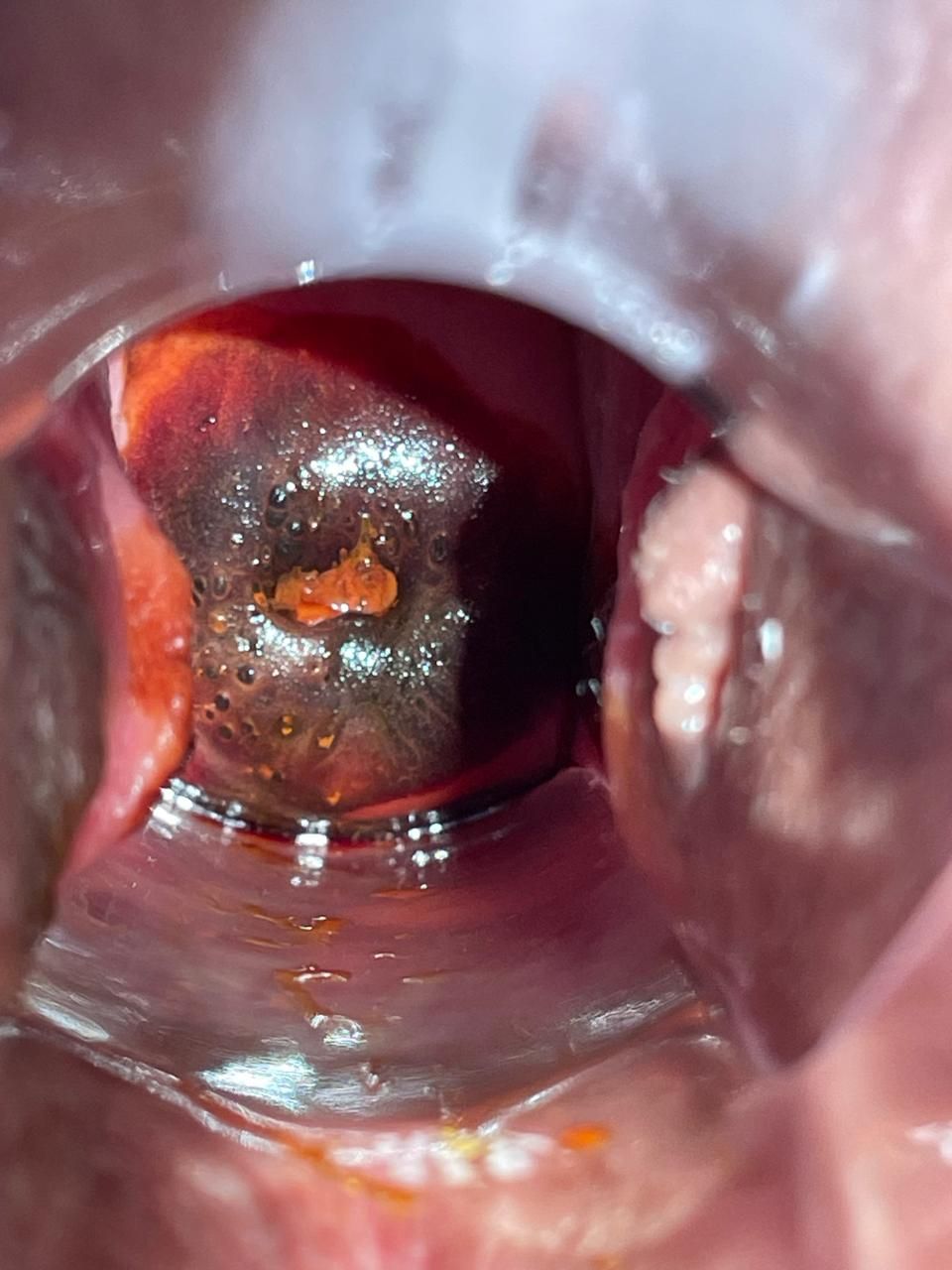 Diego Hernando Diaz Botero-10