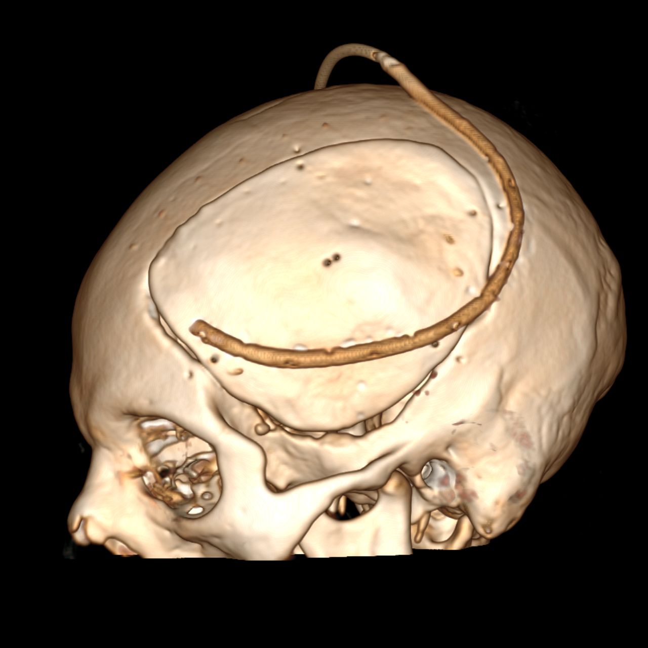 David Tafur Muñoz-1193