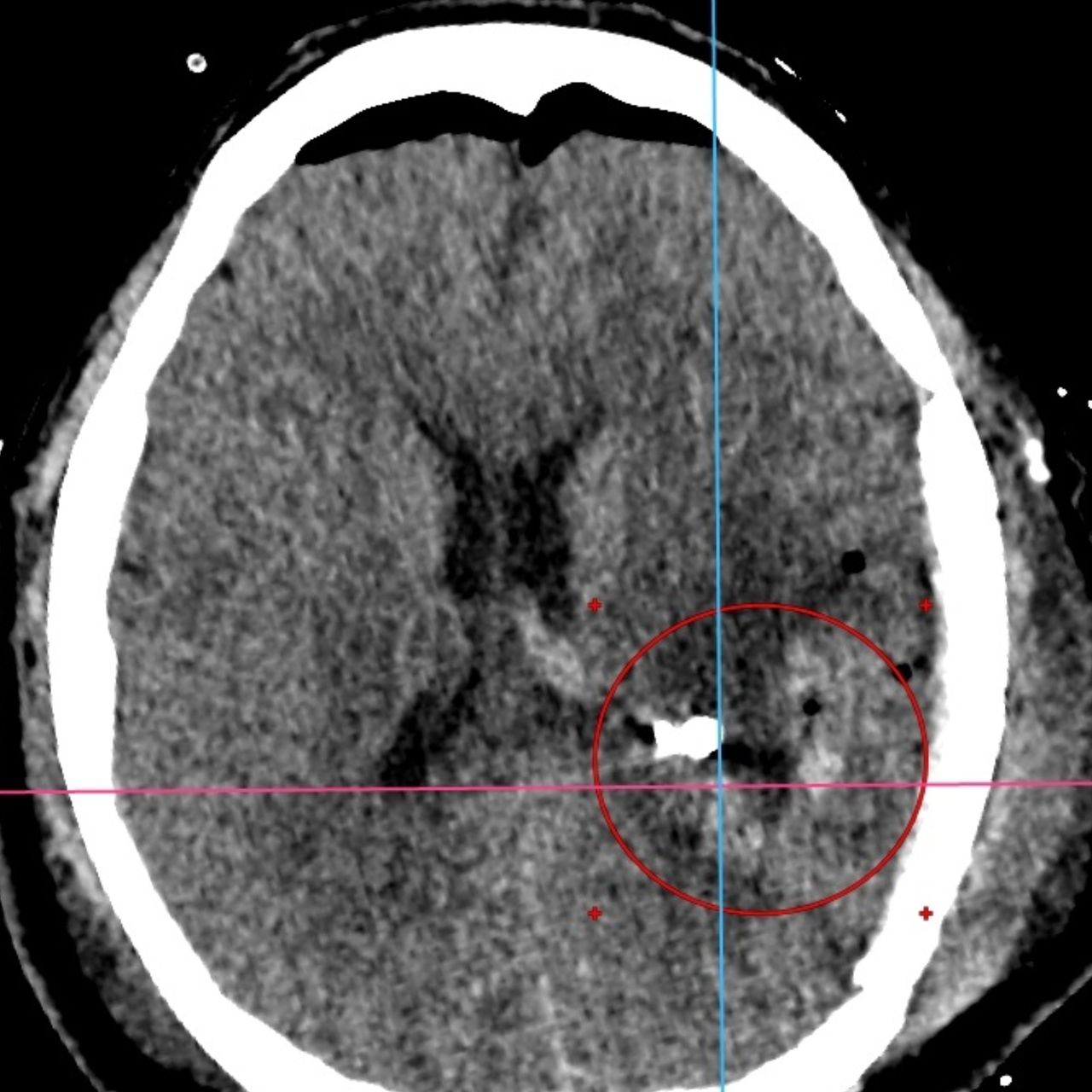 David Tafur Muñoz-1330