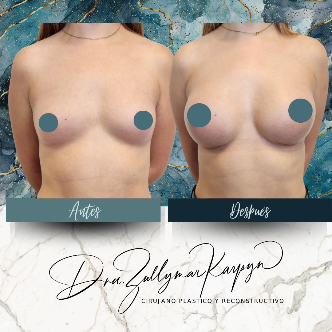 Zullymar Karpyn Brito-13