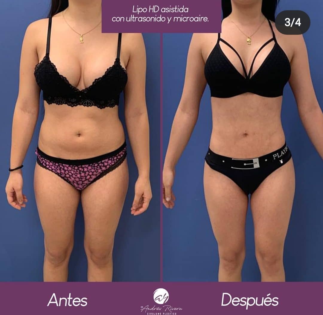 Andrés Rivera López-27