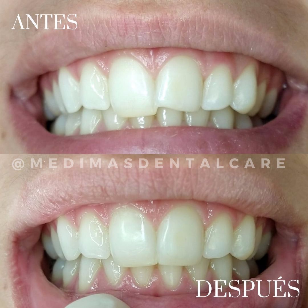 Raul Alvarado Rosas-3