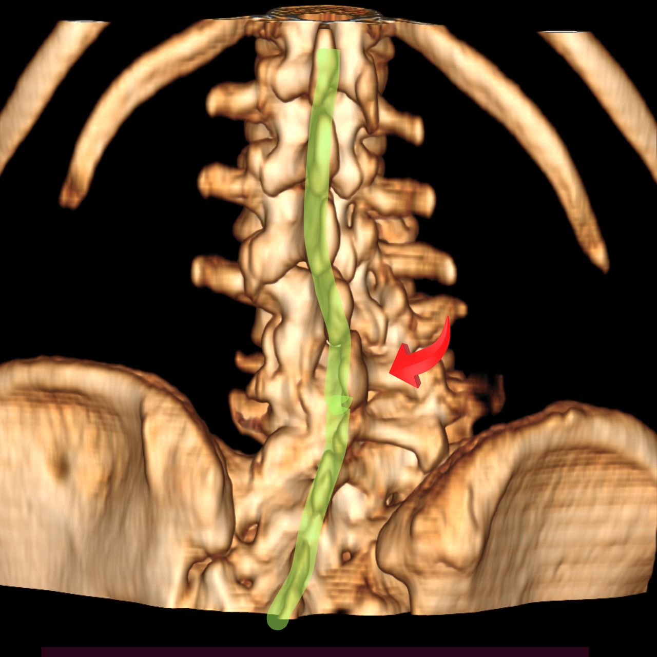 David Tafur Muñoz-1499