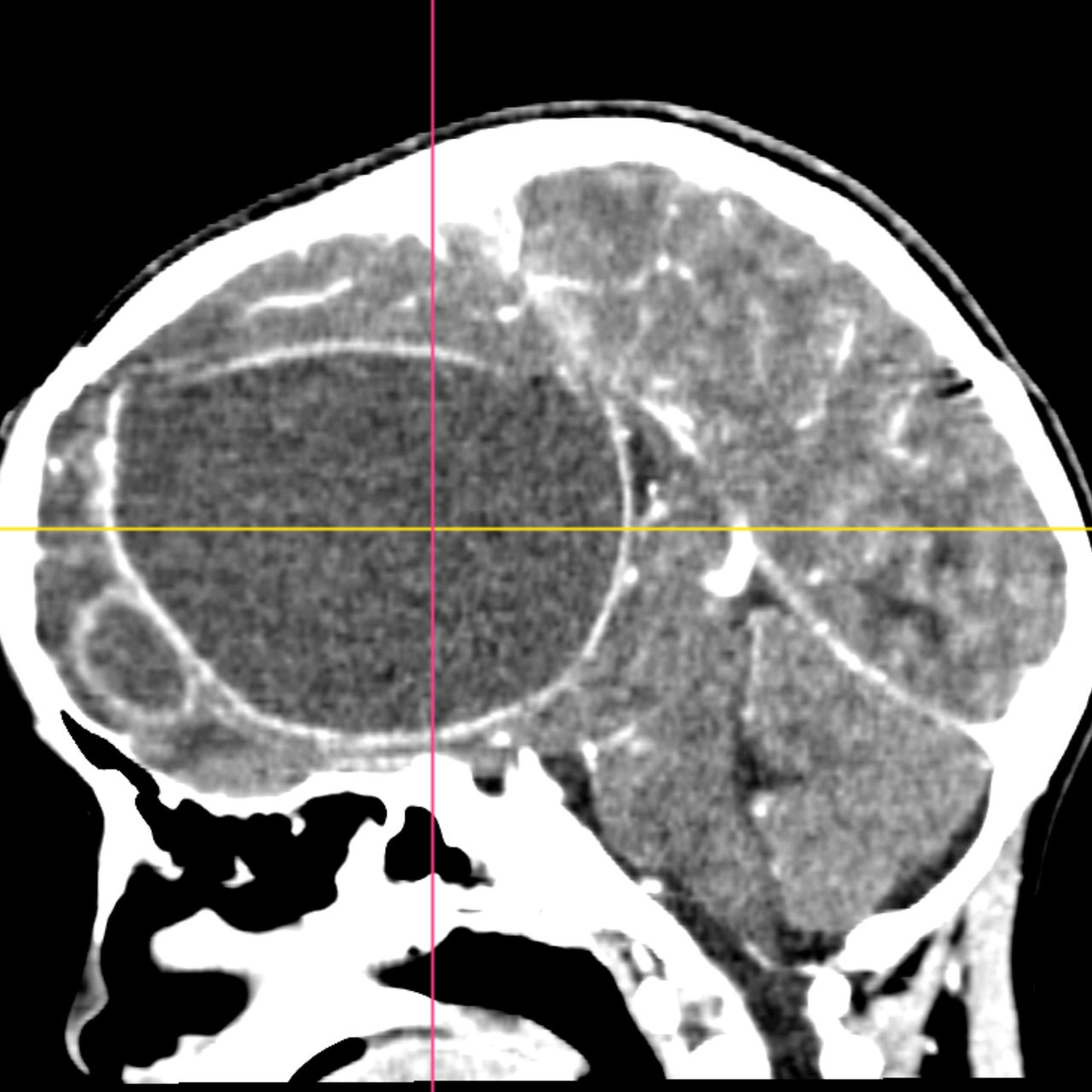 David Tafur Muñoz-1727