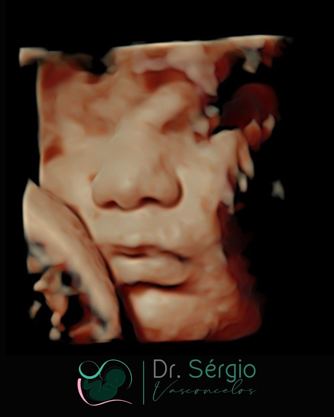 Sérgio De Abreu Vasconcelos Neto-11